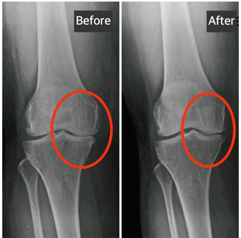 Knee improvement close-up